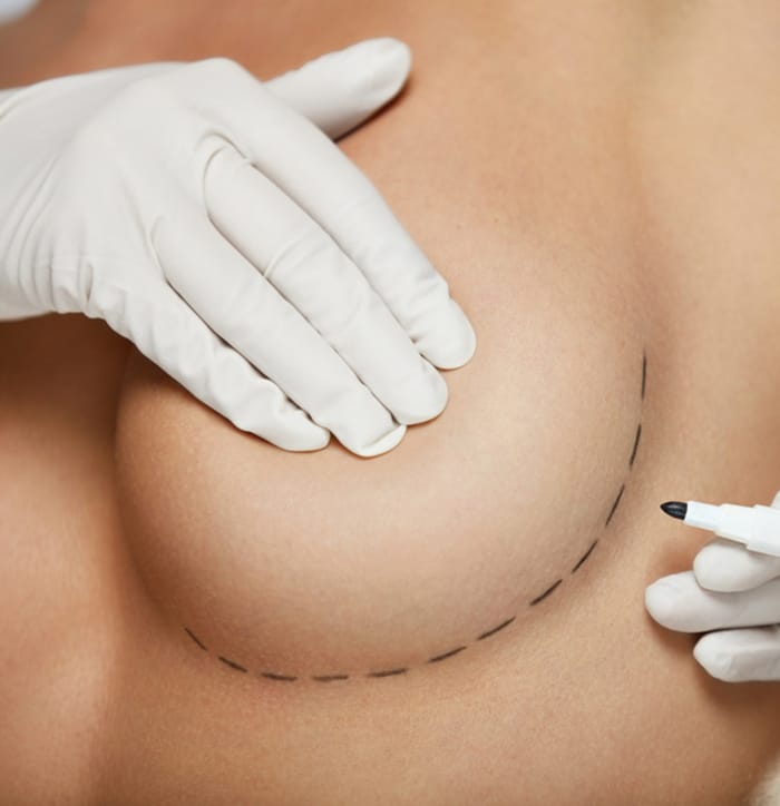Choose board-certified plastic surgeons