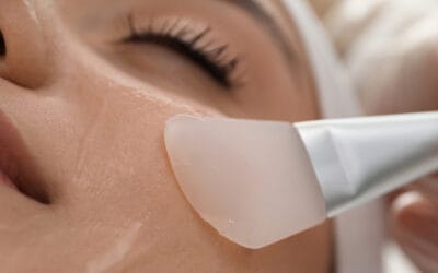 Reversing Sun Damage and Aging Through Chemical Peels
