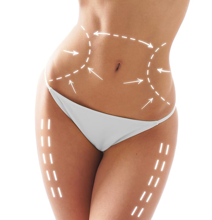 Can you shorten plastic surgery recovery time?