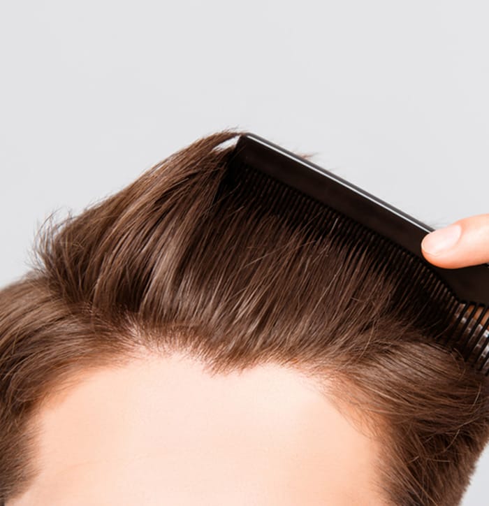 What is involved in a PRP treatment for hair?