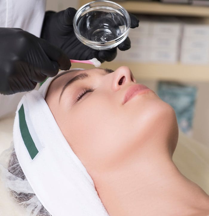 The Different Kinds of Chemical Peels