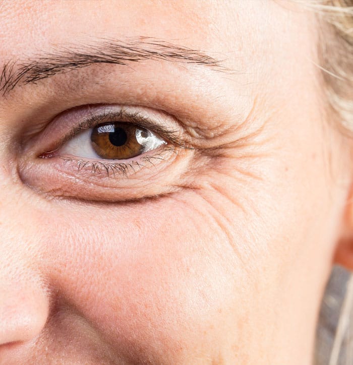 Enhancing eyelid surgery results
