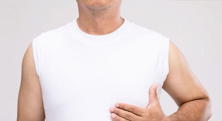 Gynecomastia