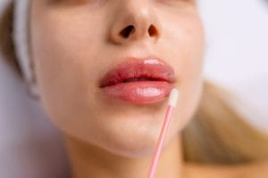 Enhance Your Natural Beauty: The Benefits of Lip Fillers for a Subtle, Confident Look