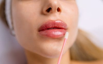 Enhance Your Natural Beauty: The Benefits of Lip Fillers for a Subtle, Confident Look