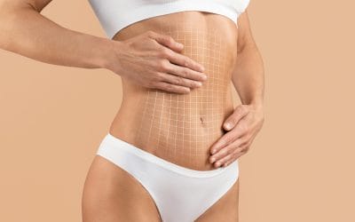 What Is a Tummy Tuck and How Can It Help You Regain Confidence?