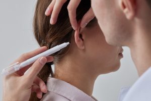 Otoplasty: Ears That Fit Your Confidence