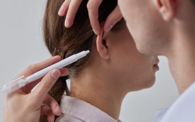 Otoplasty: Ears That Fit Your Confidence