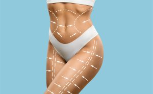 Winter Is the Best Time for Body Contouring