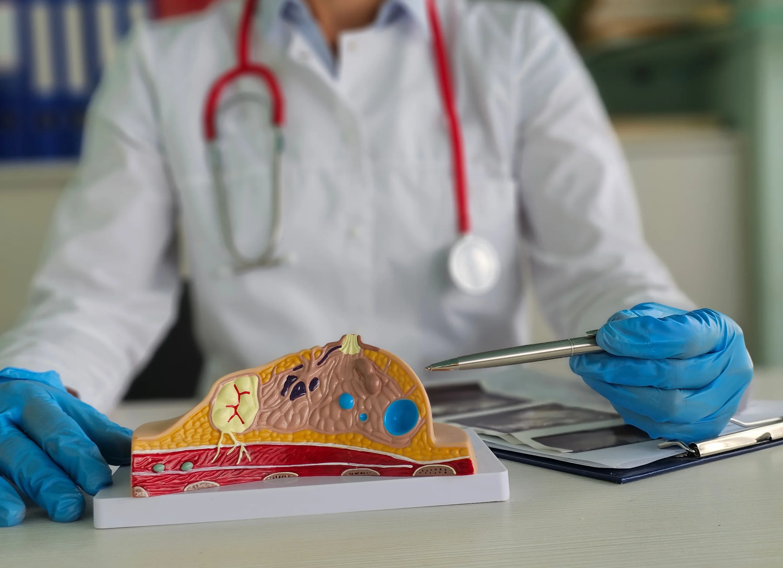 shutterstock_2494937769 Preparing for Liposuction